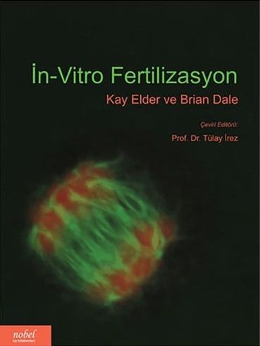 İn-Vitro Fertilizasyon