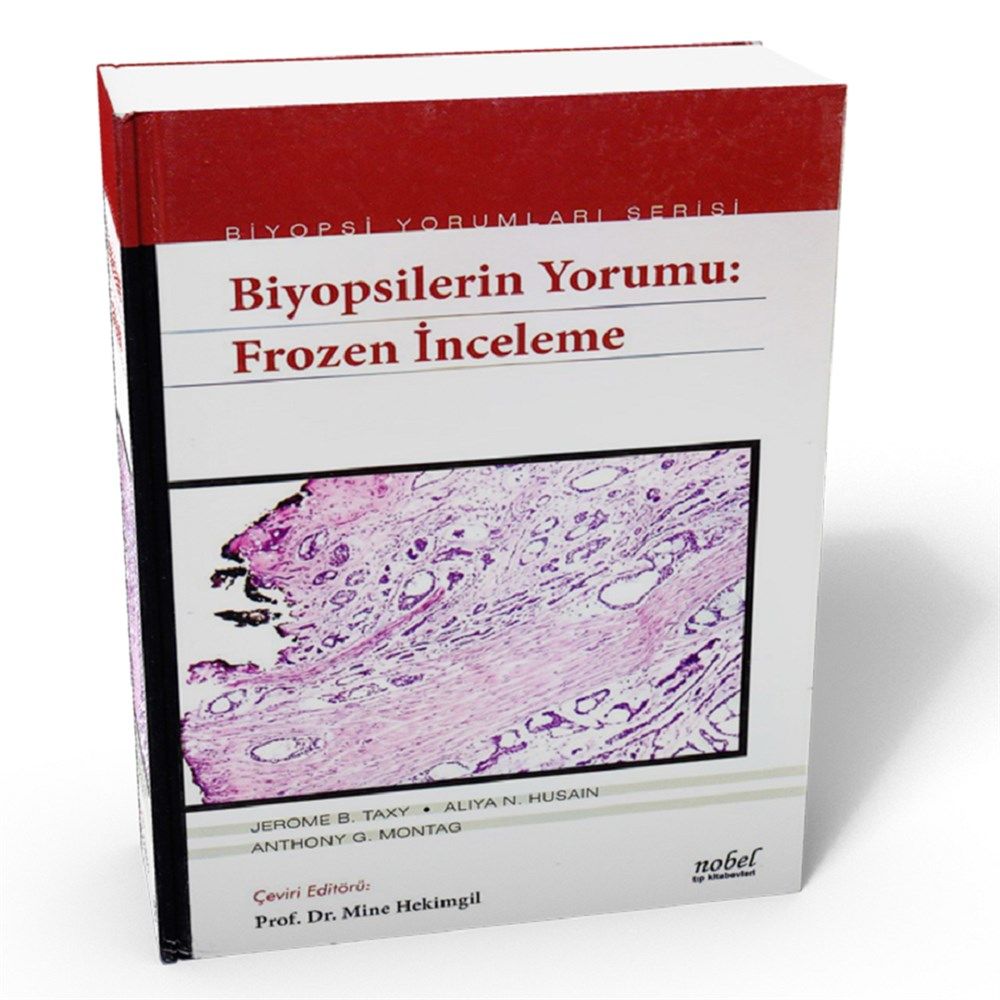Biyopsilerin Yorumu: Frozen İnceleme - Biyopsi Yorumları Serisi