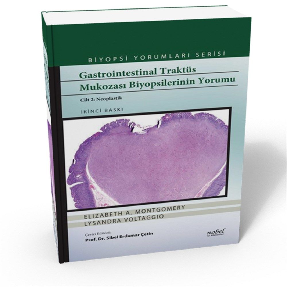 Gastrointestinal Traktüs Mukozası Biyopsilerinin Yorumu Cilt 2: Neoplastik - Biyopsi Yorumları Serisi