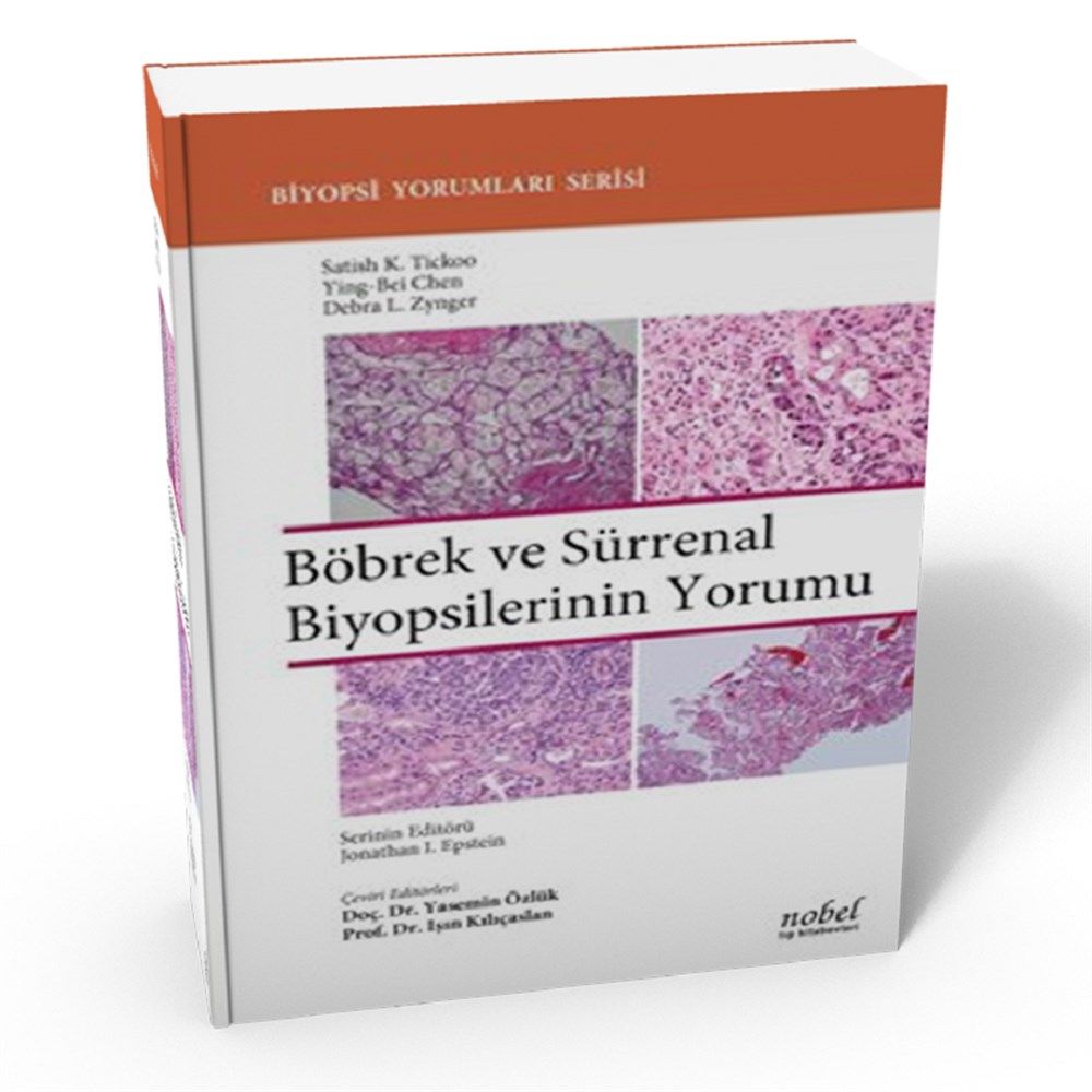 Böbrek ve Sürrenal Biyopsilerinin Yorumu - Biyopsi Yorumları Serisi