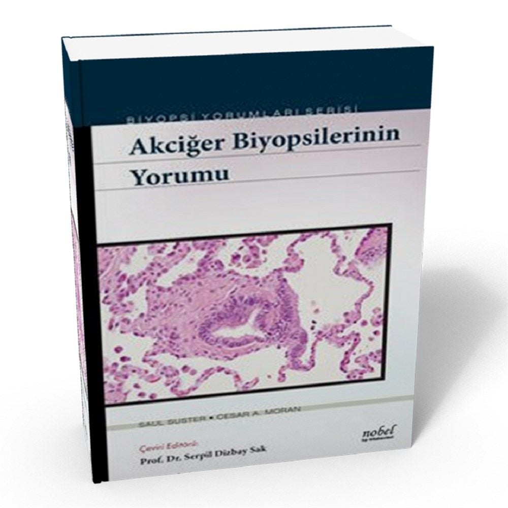 Akciğer Biyopsilerinin Yorumu - Biyopsi Yorumları Serisi