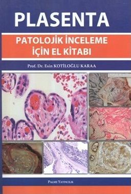 PLASENTA Patolojik İnceleme İçin El Kitabı