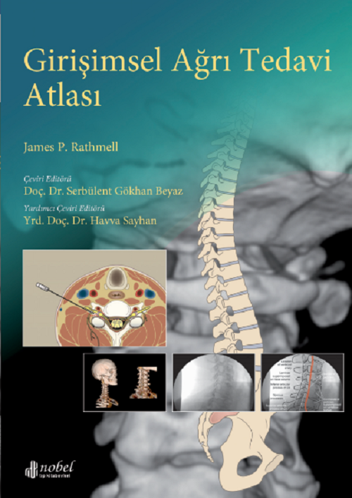Girişimsel Ağrı Tedavi Atlası