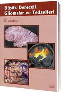 Düşük Dereceli Gliomalar ve Tedavileri