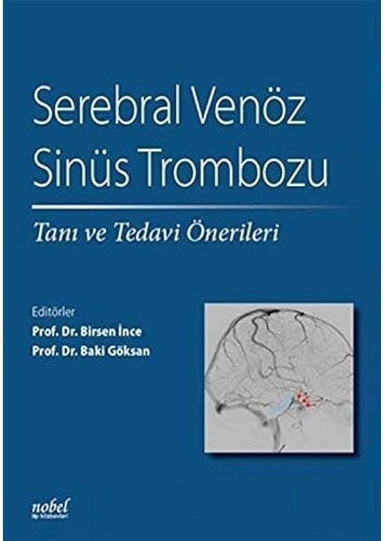 Serebral Venöz Sinüs Trombozu: Tanı ve Tedavi Önerileri