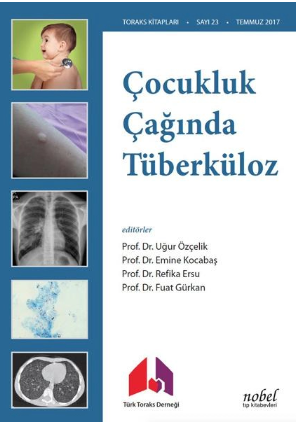 Çocukluk Çağında Tüberküloz Tanı: Tedavi ve Korumada Güncel Yaklaşımlar ve Olgu Örnekleri